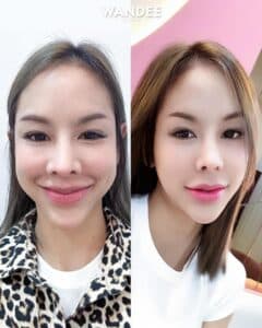 รีวิวฟิลเลอร์