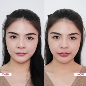 รีวิวฟิลเลอร์