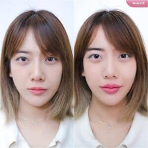 รีวิวฟิลเลอร์