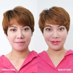 รีวิวฟิลเลอร์