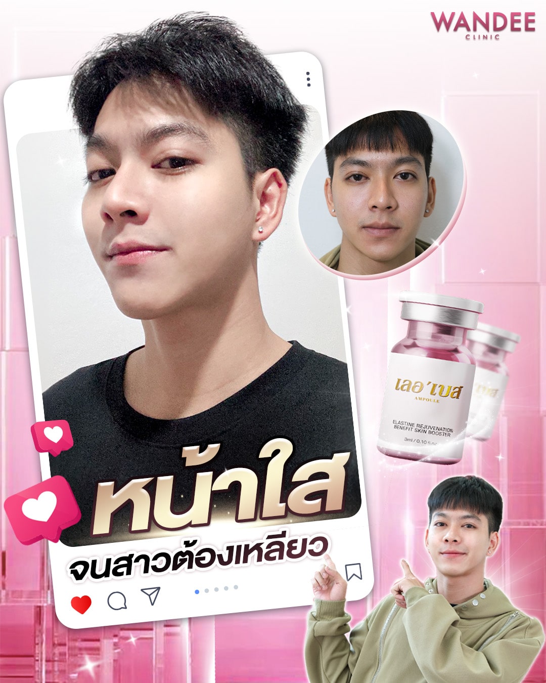 ฉีดสิว ร้อยเอ็ด