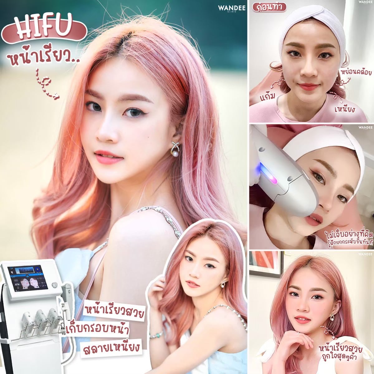 Hifu ร้อยเอ็ด