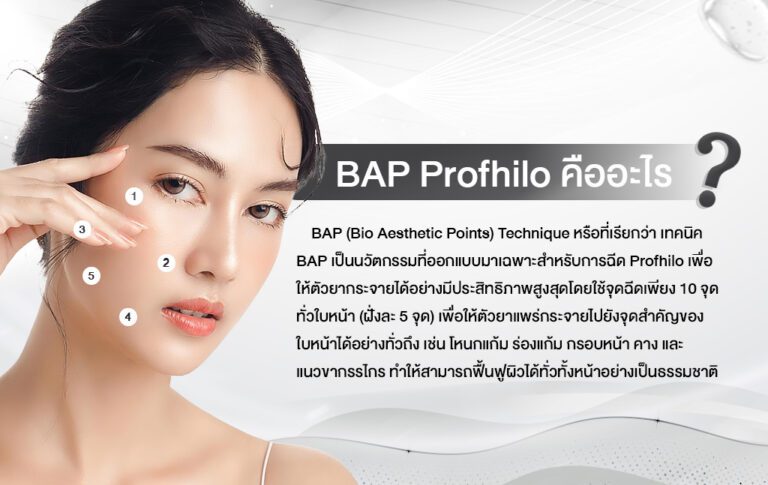 Profhilo ร้อยเอ็ด