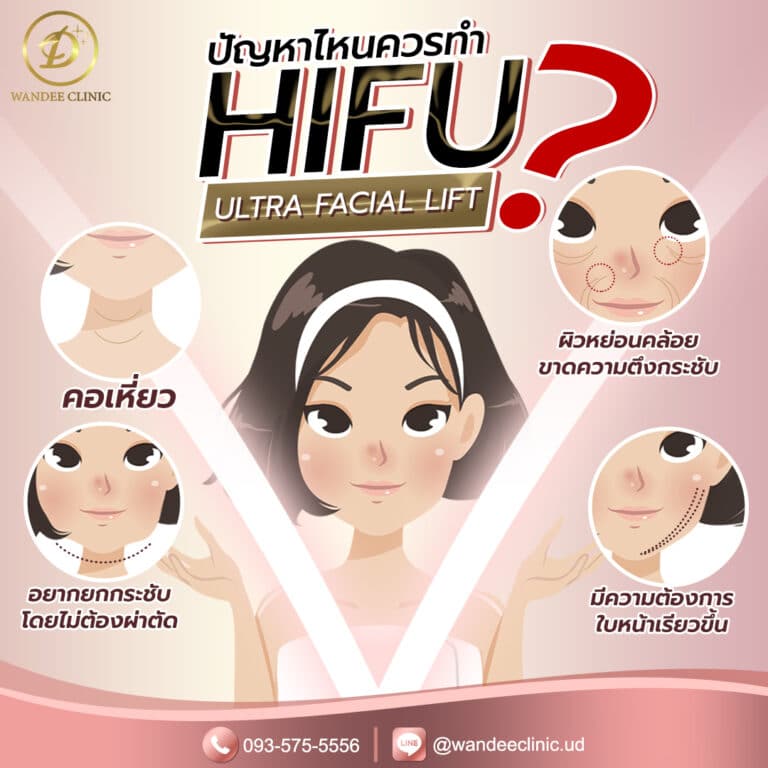 Hifu ร้อยเอ็ด