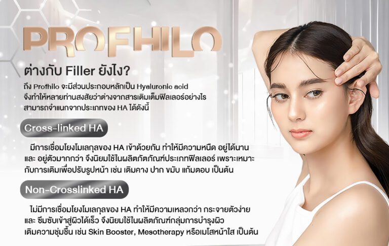 Profhilo ร้อยเอ็ด