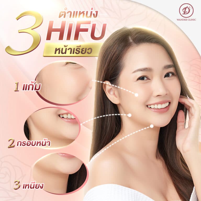 Hifu ร้อยเอ็ด
