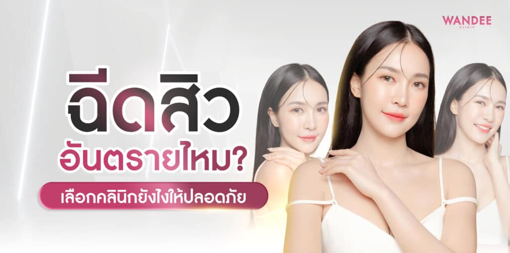 ฉีดสิว ร้อยเอ็ด