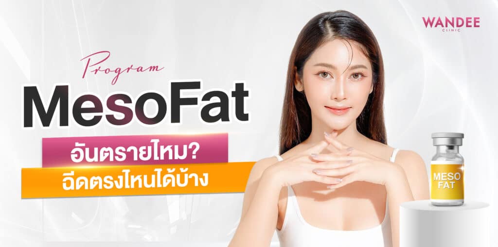 เมโสแฟต ร้อยเอ็ด