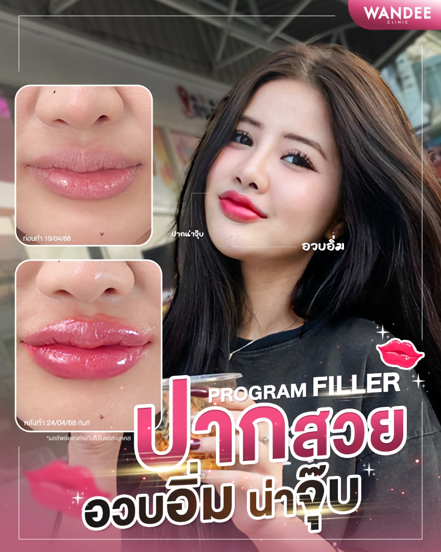 ทรงปากสายฝอ