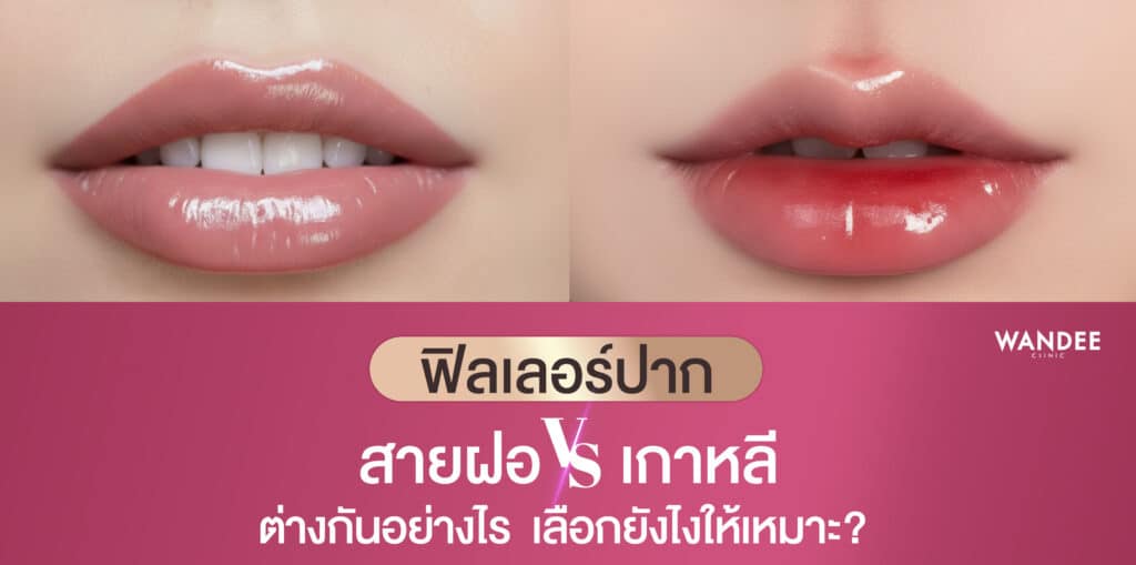 ฟิลเลอร์ปาก-สายฝอ-vs-เกาหลี