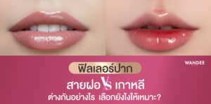 ฟิลเลอร์ปาก-สายฝอ-vs-เกาหลี