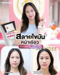 รีวิว Oligio