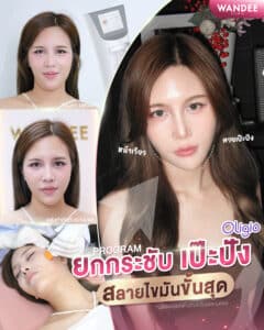 รีวิว Oligio