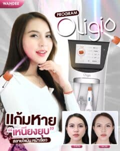 รีวิว Oligio