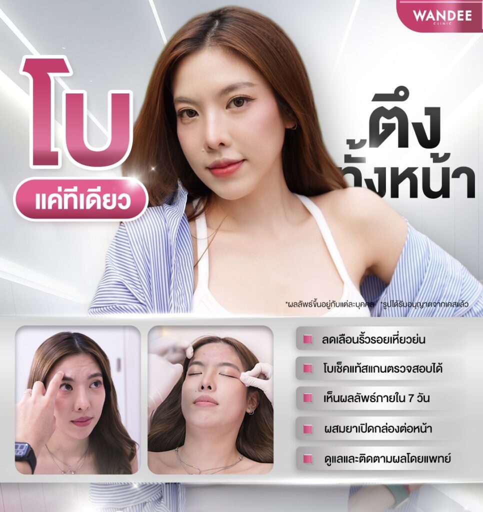 โบท็อกซ์