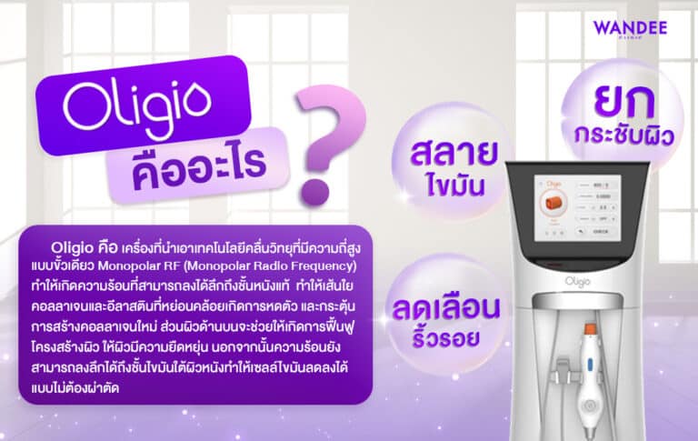 oligio คืออะไร
