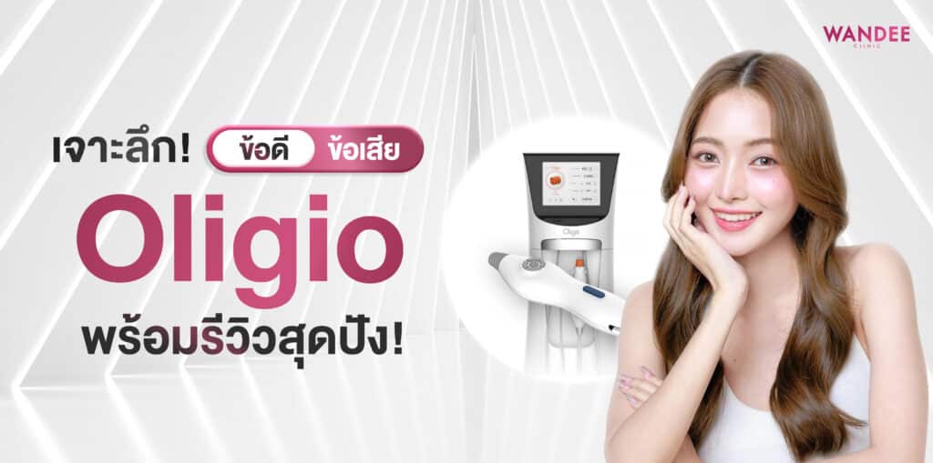 Oligio ร้อยเอ็ด